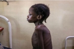 Con số khủng khiếp: 10.000 trẻ em tử vong mỗi tháng vì nạn đói liên quan đến đại dịch Covid-19