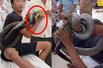 Người đàn ông mang rắn hổ mang đến bệnh viện sau khi bị cắn: Tình hình sức khỏe diễn biến phức tạp