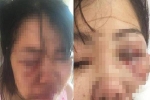 Bất ngờ lý do chồng 'đi đường quyền' khiến vợ thâm tím mặt tại Hà Nội