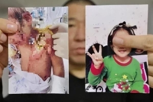 Mẹ ruột cùng nhân tình bạo hành con gái 6 tuổi 'thân tàn ma dại'