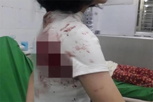 Mâu thuẫn trong trường, một nữ sinh ở Đồng Nai bị đâm trọng thương
