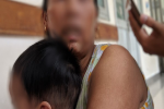 Bắt tạm giam người mẹ bạo hành con gái nhỏ ở quận 12