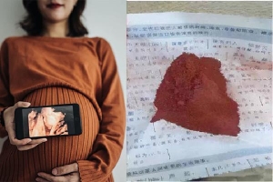 Nhiều sản phụ ở Trung Quốc đổ xô đi mua thuốc... thay đổi giới tính thai nhi