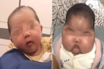 Bé gái tại Trung Quốc phát triển bất thường sau khi dùng kem dưỡng da