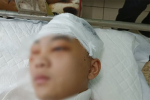 Vụ nam sinh lớp 11 bị đánh vỡ sọ não: Thông tin mới nhất về sức khỏe nạn nhân