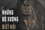 Hài cốt 'lên tiếng': Chụp X-quang 314 bộ xương, phát hiện 'sự thật kinh hoàng' cách đây 8 thế kỷ ở Anh