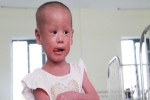 Không thể đi Singapore chữa bệnh vì dịch Covid-19, 'em bé da trăn' bị bố mẹ bỏ rơi giờ ra sao?