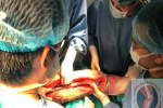 Ca phẫu thuật thay xương đùi cho bệnh nhân nhỏ tuổi nhất Việt Nam, thứ 2 thế giới