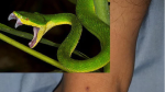 Vô tình bị rắn cắn, cần biết cách cấp cứu để tránh nguy hiểm: Bác sĩ mách 5 cách xử lý cần nhớ