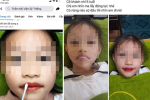 Thẩm mỹ viện phun môi cho bé gái 5 tuổi