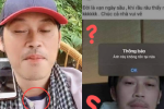 Netizen soi loạt chi tiết nghi vấn NS Hoài Linh không có vết sẹo mổ u tuyến giáp, xóa cả ảnh vì sơ hở, thực hư ra sao?