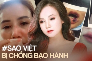 Trước 'cô Xuyến' Hoàng Yến, loạt sao Việt từng bị chồng bạo hành dã man: Dương Yến Ngọc chịu đánh 2-3 lần/tuần, 1 Hoa hậu còn muốn tự tử