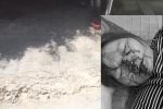 Hải Phòng: Người phụ nữ cầu cứu vì bị hàng xóm dùng lốp xe ngoặc vào cổ, kéo lê dưới đường
