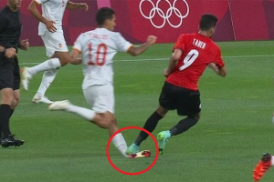 Rùng rợn: Cầu thủ Olympic Tây Ban Nha bẻ gập cổ chân vì bị đối thủ giẫm lên