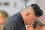 Miếng băng dán y tế trên đầu ông Kim Jong Un gây chú ý