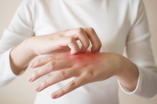 Đi ngủ thường xuyên bị tê mỏi tay có thể là tín hiệu cảnh báo của 5 căn bệnh nguy hiểm này - Ảnh 2.