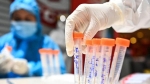 Hà Nam: Pháthiện thêm nhiều ca mắc Covid-19 qua khám sàng lọc tại cơ sở y tế