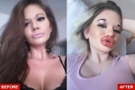 Người phụ nữ có 'đôi môi lớn nhất thế giới' chuẩn bị bơm môi lần thứ 27 vì muốn giống búp bê