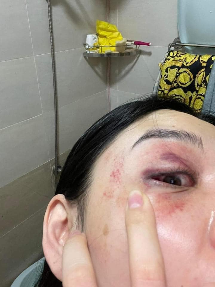 Trang Nemo gửi lời xin lỗi chân thành tới người phụ nữ bị đánh