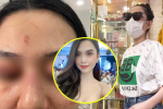 Lộ góc camera khác: Người phụ nữ bị nhóm đàn ông lao vào đánh trước shop Trang Nemo