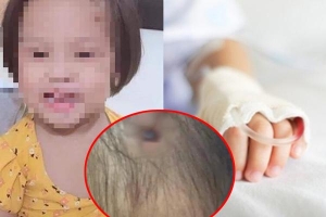 Xôn xao hình ảnh nghi là bé gái 3 tuổi bị bạo hành với chiếc đinh lớn cắm thẳng vào đầu khiến người xem không cầm được nước mắt