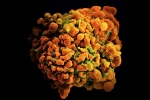 Phát hiện chủng virus HIV mới với độc lực cao