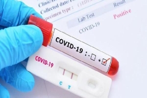 Lật hồ sơ Y tế Đức Minh nhập khẩu kit xét nghiệm COVID-19 'khủng' hơn Việt Á