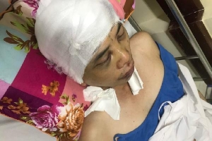 Phó Chủ tịch xã ở Hải Dương bị đánh: Lần đầu tiên nạn nhân lên tiếng
