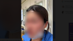 Thanh Hóa: Tiêm filler mũi đổi tài lộc, người phụ nữ phải nhập viện cấp cứu