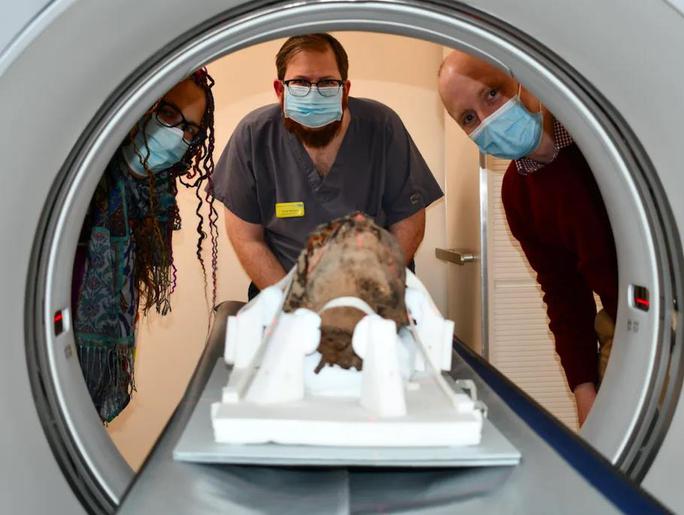 Các nhà khoa học bên chiếc đầu người đang được đưa vào máy CT - Ảnh: ĐẠI HỌC CANTEBURY CHRIST CHURH/ BỆNH VIỆN MAIDSTONE.