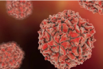 New York phát hiện virus bại liệt trong nước thải