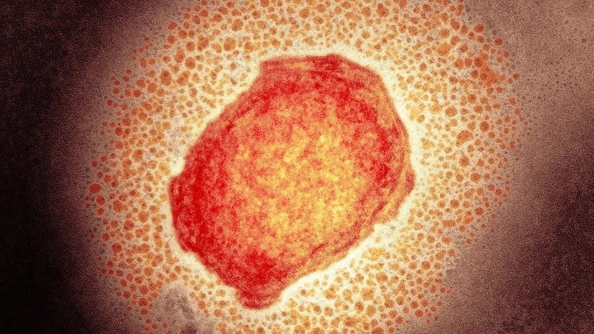Phân tử virus gây bệnh đậu mùa khỉ. Ảnh: Science Photo Library.