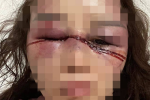 Thanh Hóa: Người phụ nữ bị hành hung dã man trong đêm