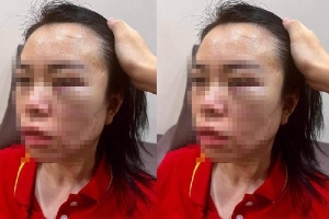 Hà Nội: Nghi vấn người phụ nữ bị chồng cũ bắt giữ, đánh đập