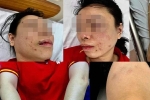 Người phụ nữ tố bị chồng cũ 'bắt cóc' tra tấn dã man: Nhốt trong ô tô, đánh từ Hà Nội lên Hòa Bình