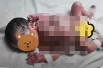 Sửng sốt bé trai chào đời với 4 tay, 4 chân và 2 bộ phận sinh dục