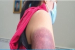 Bảo vệ dân phố đánh người phụ nữ ở TP.HCM
