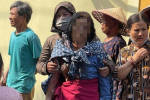Vụ con gái phóng hỏa nhà mẹ: Người mẹ được ghép da