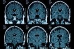 Não của thanh thiếu niên có dấu hiệu lão hóa nhanh hơn sau đại dịch COVID-19