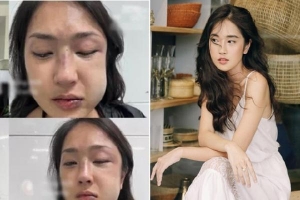 Bạn trai đăng bài xin lỗi MC Misoa Kim Anh sau khi tác động vật lý với người yêu