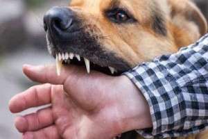 Bị chó dại cắn vào ngón tay, một người tử vong