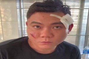 Khánh Hòa: Bắt tạm giam nghi phạm nổ súng khiến 2 người bị trúng đạn