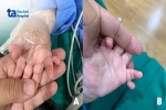 Bé gái sinh ra khác thường với 24 ngón tay, chân