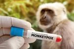 Chuyên gia nhận định gì về nguy cơ lây lan bệnh đậu mùa khỉ?