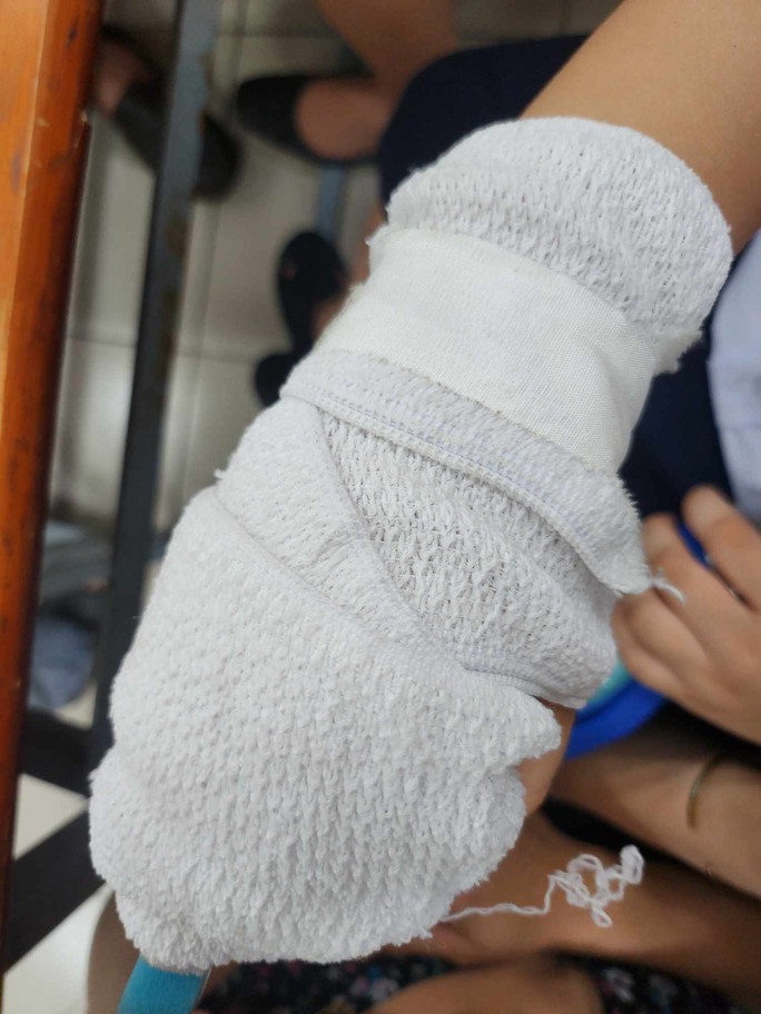 Kỷ luật cảnh cáo giáo viên đánh gãy xương ngón tay học sinh ở Tân Bình  - Ảnh 2.