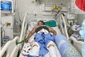 Bệnh nhân 49 tuổi 'sốc chồng sốc' do tai nạn giao thông nguy kịch và sốt xuất huyết Dengue